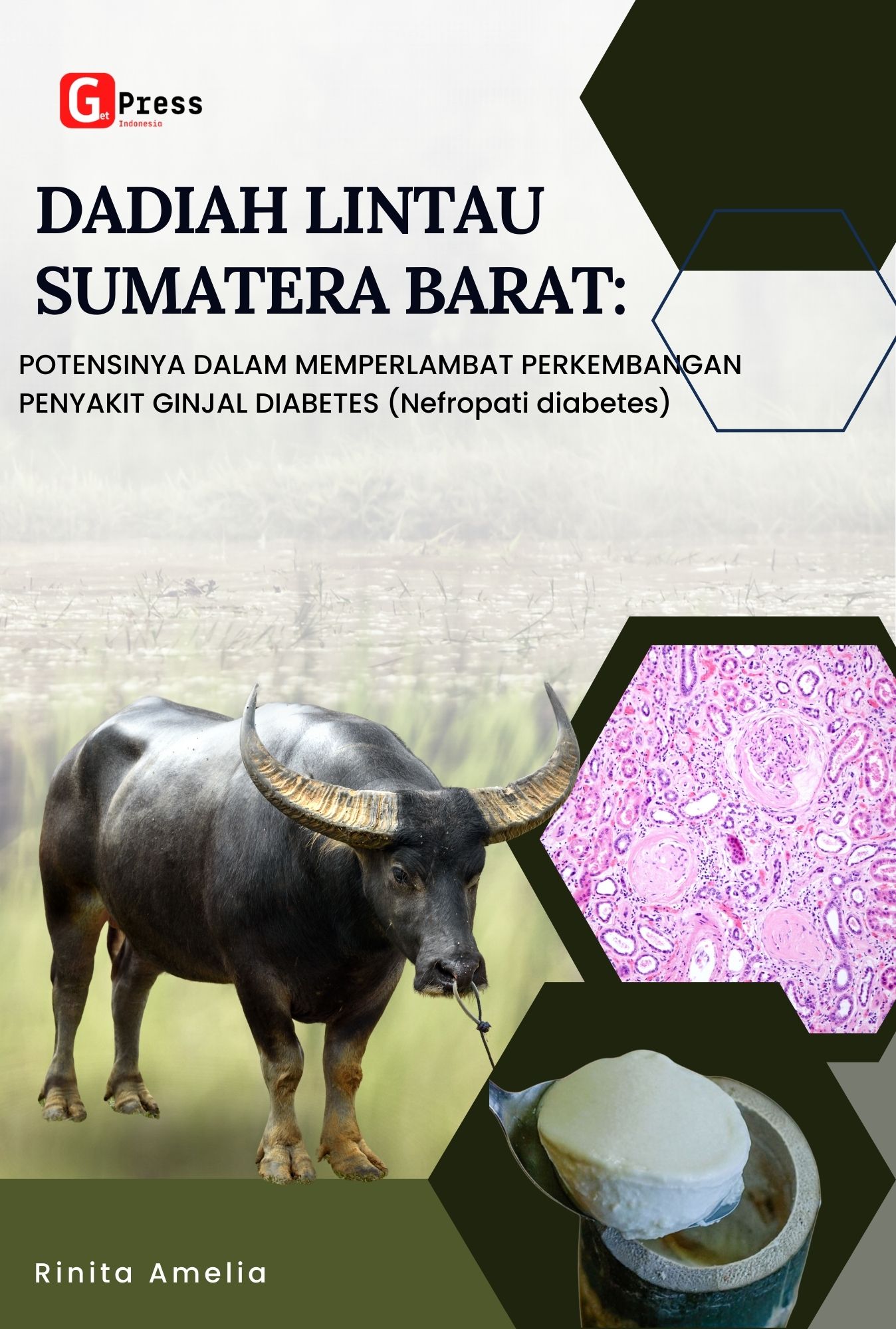 DADIAH LINTAU SUMATERA BARAT: POTENSINYA DALAM MEMPERLAMBAT PERKEMBANGAN PENYAKIT GINJAL DIABETES (Nefropati diabetes)